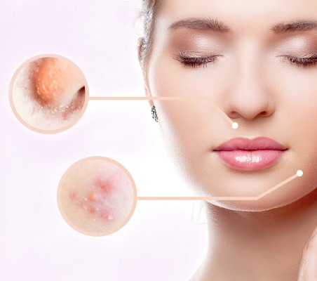 Laser skin treatment in Hazratganj Lucknow